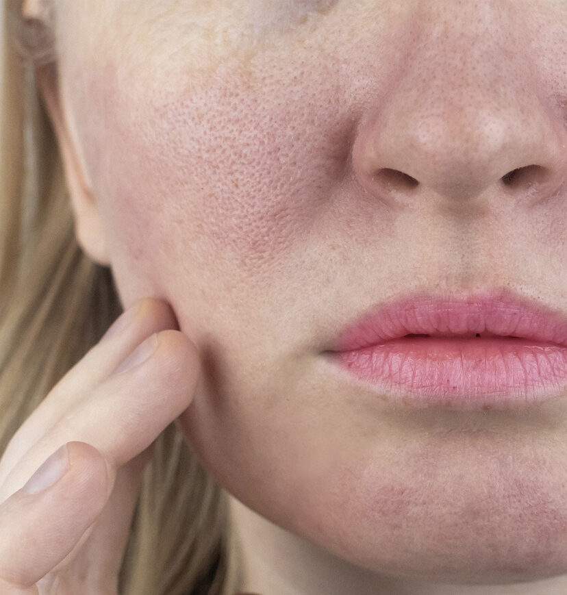 Photo of a woman's cheek, nose, and lips
