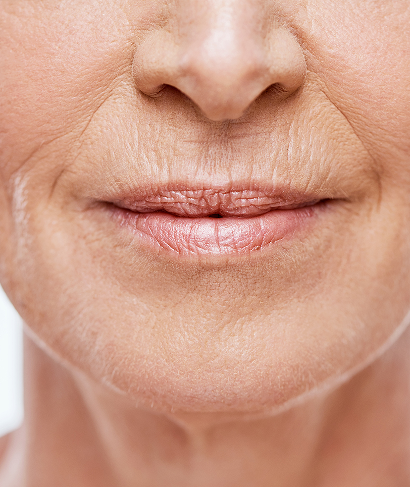 Close-up photo of a wrinkles on a woman's face